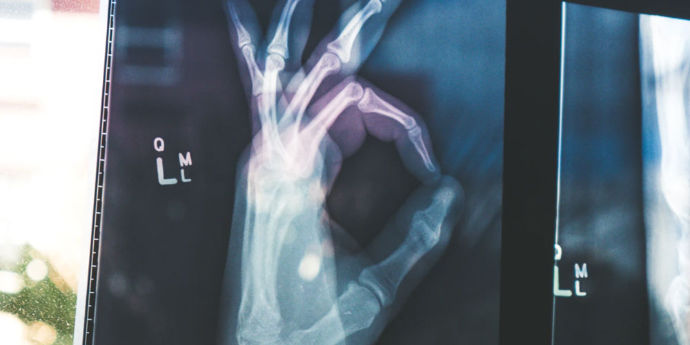 X-Ray of an OK sign